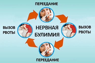Лечение булимии в Ханской